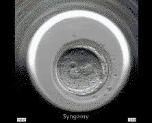 A human egg cell after fertilization - amazing