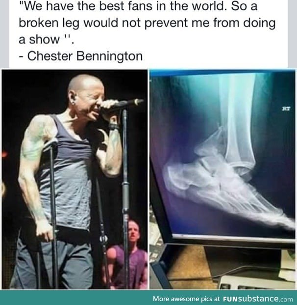 Chester Bennington, Singer of Linkin Park