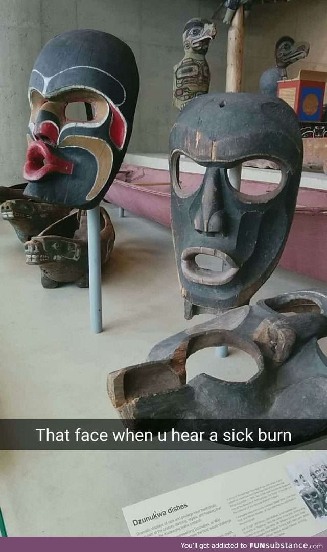 Sick burn