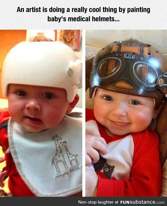 Baby medical helmets