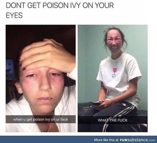 Don't get poison ivy on your eyes