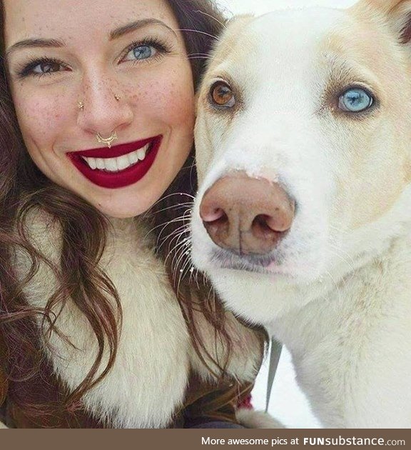 Heterochromia