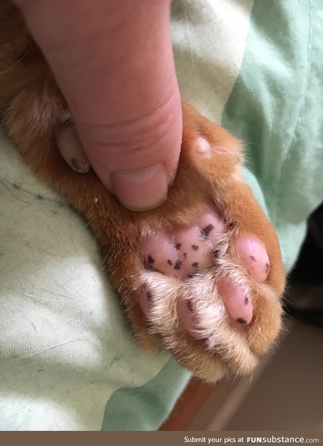 My kijje has freckles on his push beans