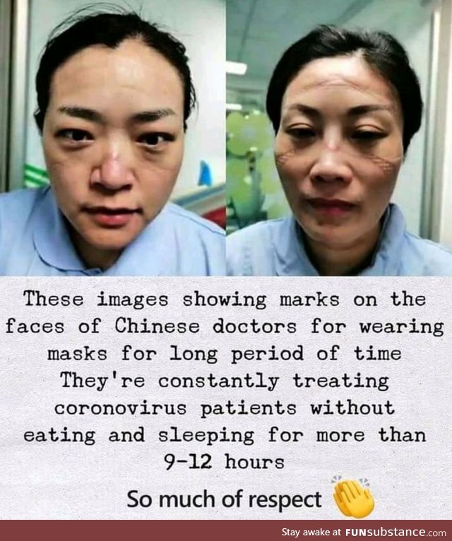 Doctors are the best