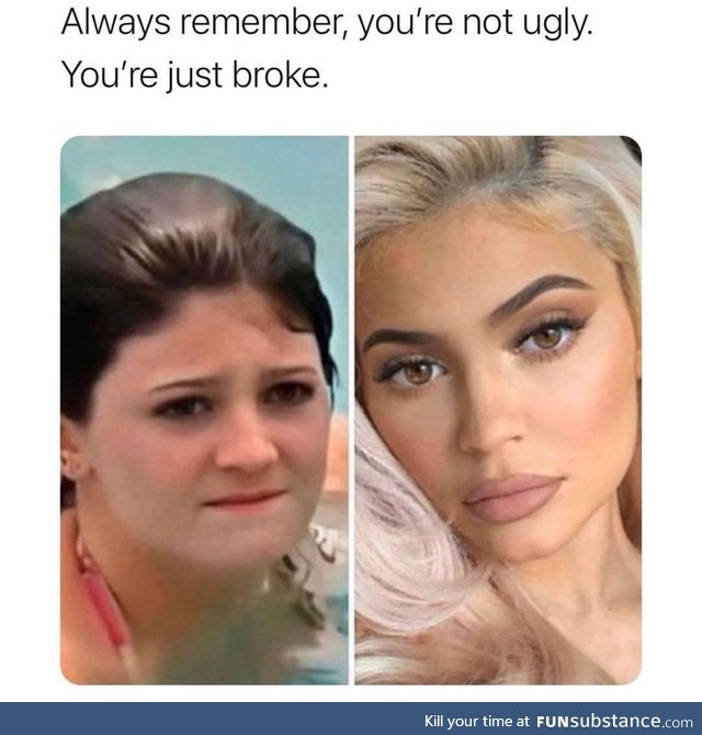 You are not ugly, you are just broke