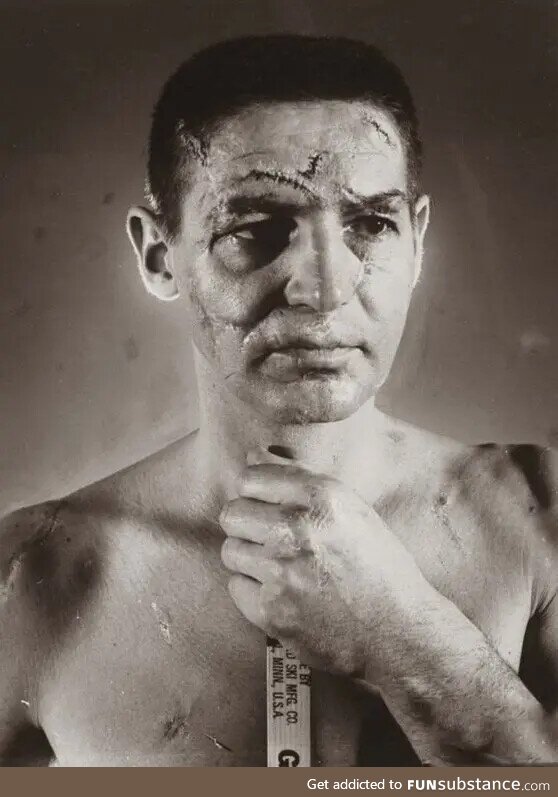 Terry Sawchuk – The face of a hockey goalie before masks became standard game