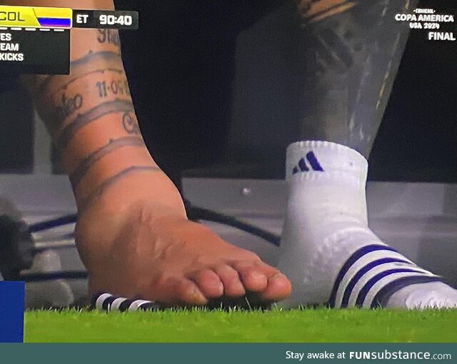Lionel Messi's Ankle