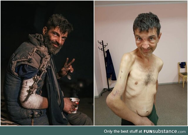 Mykhailo Dianov in the right photo after being released from Russian captivity