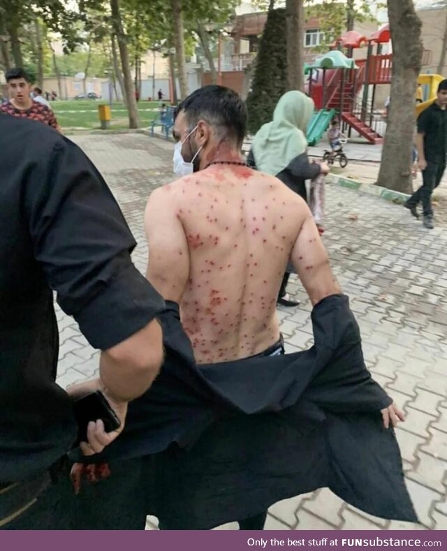 Man shielded many women and took all pallets shotgun on himself during anti hizab protest