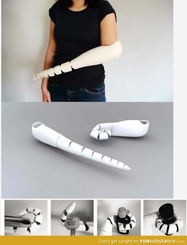 New bionic arm