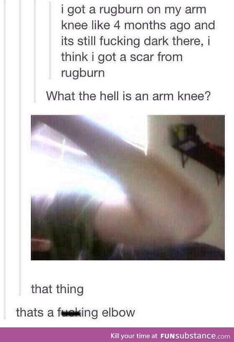 I hurt my arm knee :(