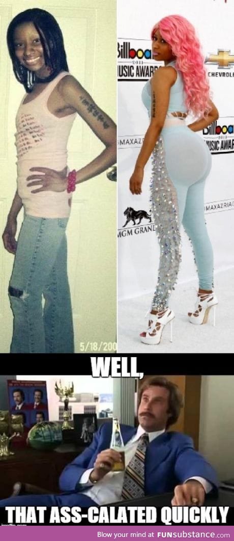 Nicki Minaj, before and after surgery