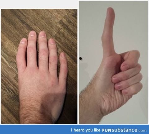 Five fingers, no thumb