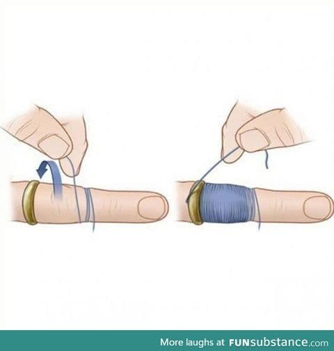 How to remove a ring that wouldn't come out