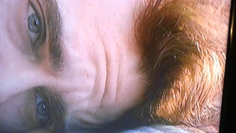 Joaquin Phoenix's forehead face