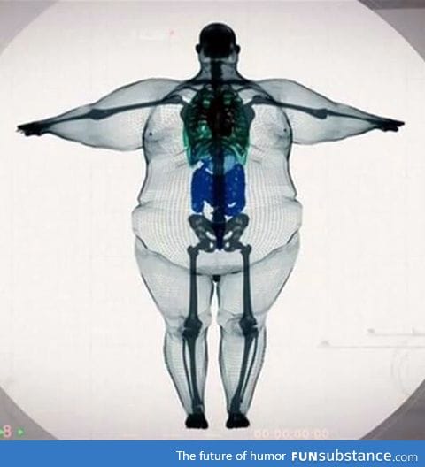 Nobody is "big-boned". Please, take care of yourselves