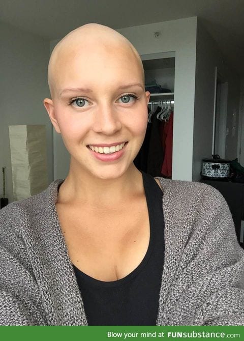 "After months of hanging onto my thinning hair, I finally let go and shaved my head"