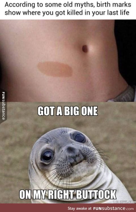 Birthmarks?