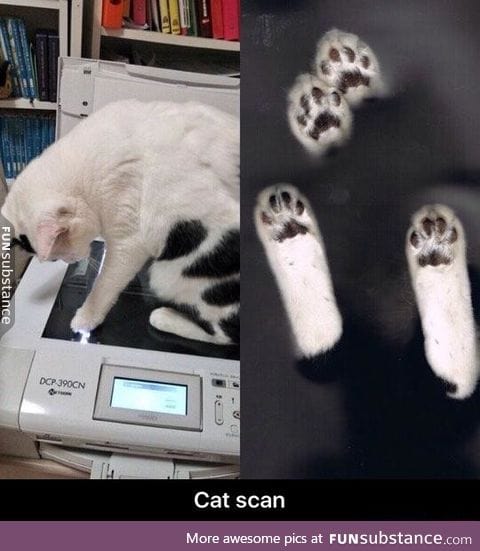 Cat scan