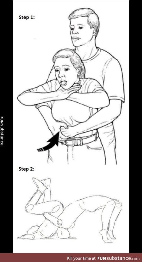 Heimlich maneuver