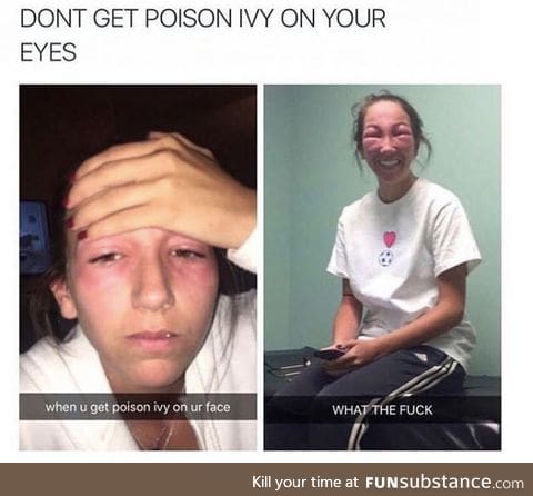 Don't get poison ivy on your eyes