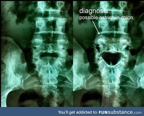 The diagnosis