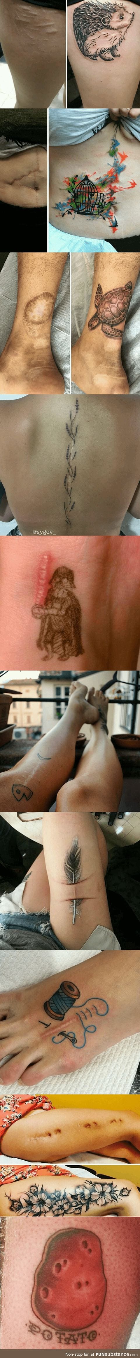 Amazing tattoos that turn scars into Works of Art