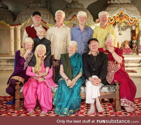 Three generations of an albino family in India
