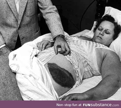 Ann Hodges. The only person in history to be struck by a meteorite. (1954)