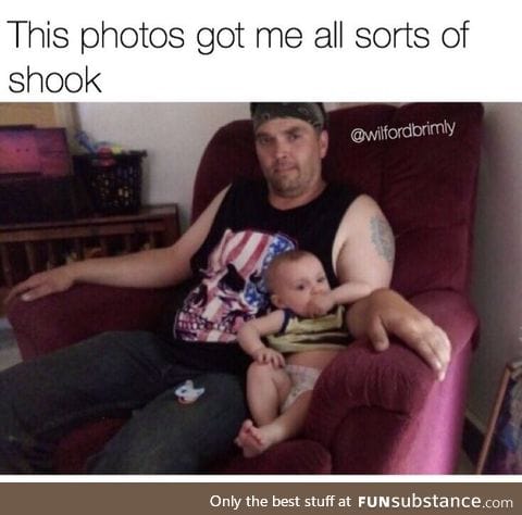 Baby has adult hands