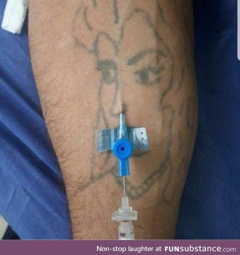 What happens when you give an ENT doctor an IV cannula