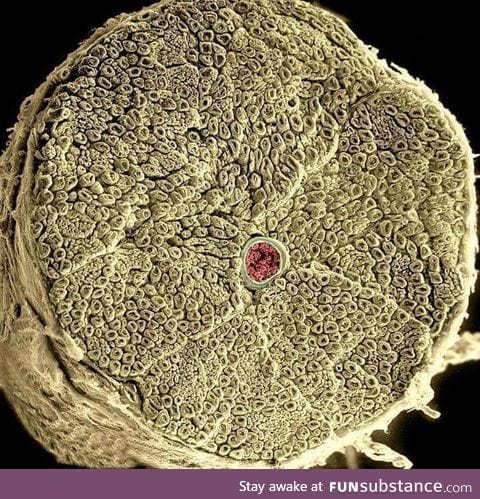 Human spinal nerve taken with electron micrograph