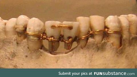 Ancient Egyptian dentistry
