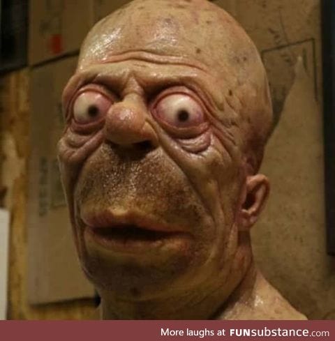 So this is what real life Homer Simpson would look like after years of alcoholism