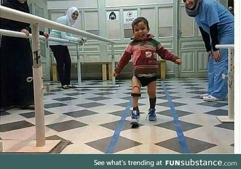 A Syrian kid after receiving a synthetic leg