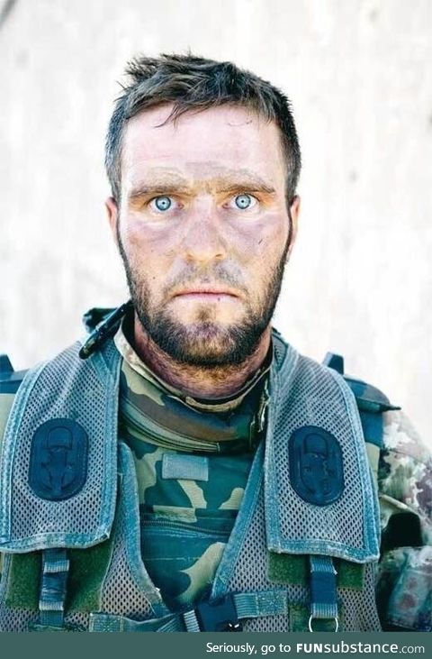 The thousand yard stare- an Italian soldier, his photo taken after three consecutive days