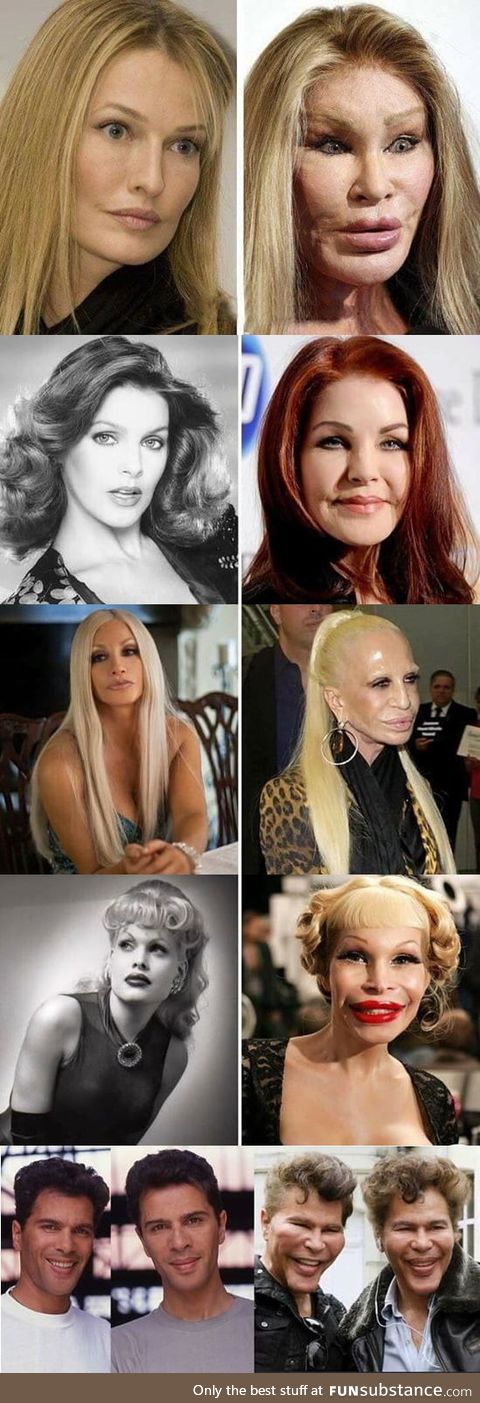 Wonders of modern plastic surgery