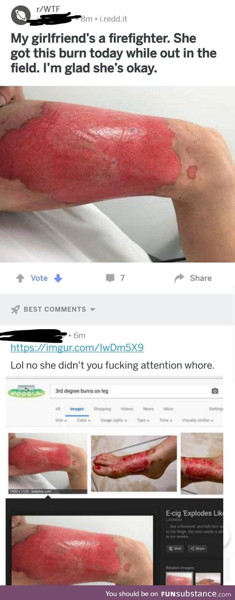 GF burn