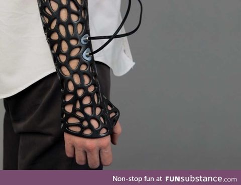 This 3D-printed cast uses ultrasound to heal broken bones 40% faster