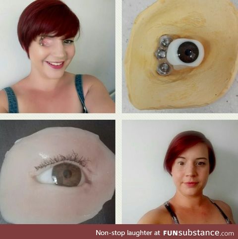 Prosthetic eye