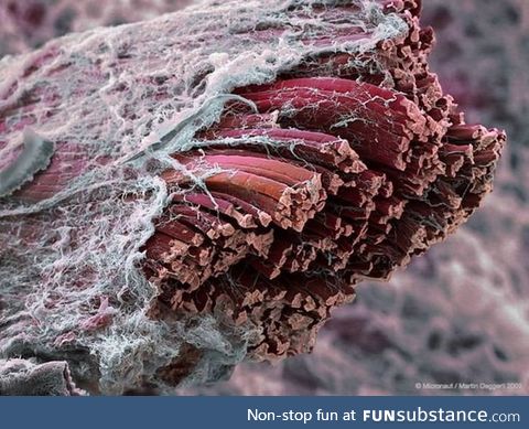 Muscle tissue through electron microscope