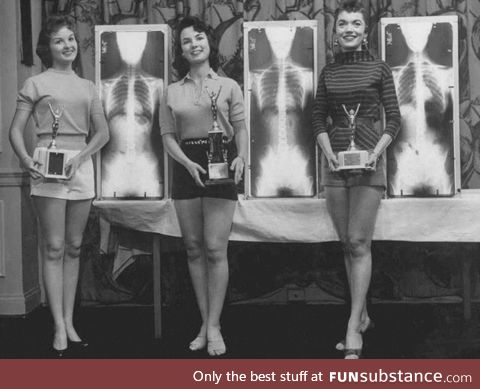 1st, 2nd and 3rd Place in the Miss Correct Posture Contest pose with their X-Rays