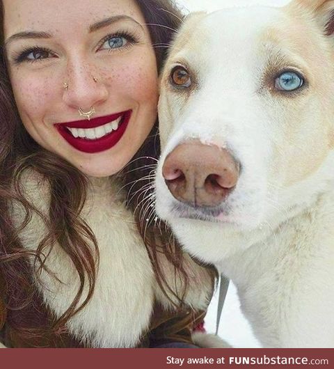 Heterochromia