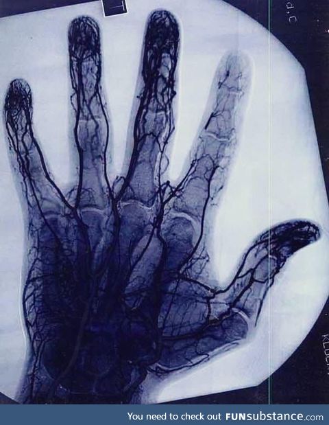 The blood vessels of a professional yo-yoist