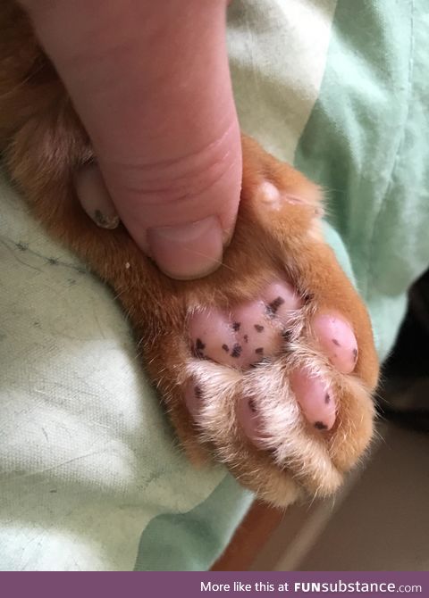 My kijje has freckles on his push beans