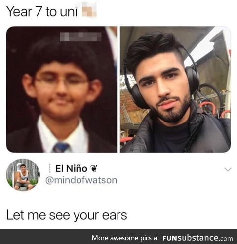Those are his new ears