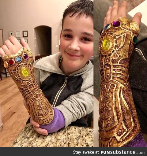 The *best* thing for a broken arm