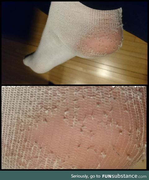 What do you mean by hole in my sock?