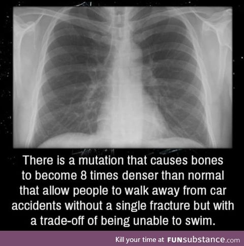 In 1994, an athletic man we'll call John was involved in a car crash. He was