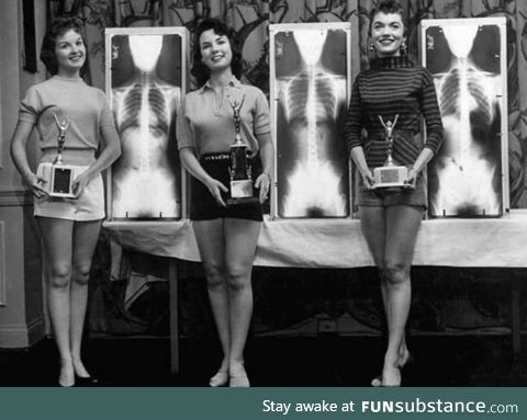 Winners of the Miss Beautiful Spine contest, cervical 1956